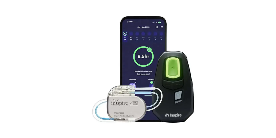 Inspire Sleep Apnea Implant Device